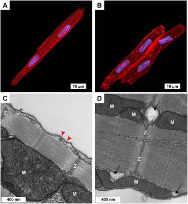 Three-Week-Old Rabbit Ventricular Cardiomyocytes as a Novel System to Study Cardiac Excitation and EC Coupling